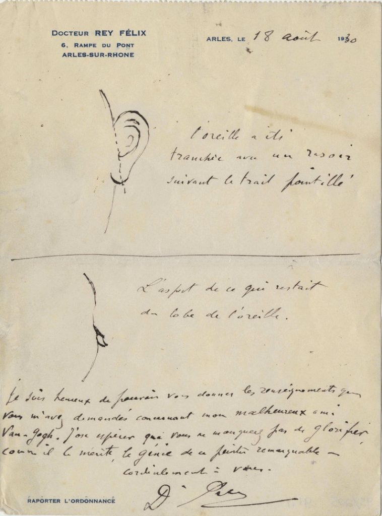 O schiță în care se arată cum și-a tăiat urechea. Schița a fost făcută în 18 august 1930 de doctorul Félix Rey, cel care l-a îngrijit pe van Gogh, la cererea scriitorului Irving Stone. Acesta se documenta pentru cartea lui dedicată vieții pictorului olandez. | Sursa: Vincent van Gogh Letters